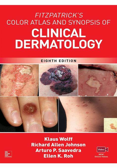 Fitzpatrick's Color Atlas and Synopsis of Clinical Dermatology, 8e